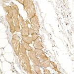 Dystrophin Antibody in Immunohistochemistry (Paraffin) (IHC (P))