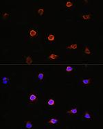 AIPL1 Antibody in Immunocytochemistry (ICC/IF)