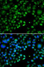 TXNDC5 Antibody in Immunocytochemistry (ICC/IF)