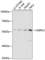ORP2 Antibody in Western Blot (WB)