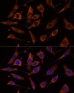 RPL24 Antibody in Immunocytochemistry (ICC/IF)