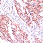 RPL24 Antibody in Immunohistochemistry (Paraffin) (IHC (P))