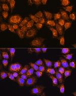 RABL3 Antibody in Immunocytochemistry (ICC/IF)