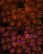 NDUFAF4 Antibody in Immunocytochemistry (ICC/IF)