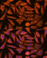 NDUFAF4 Antibody in Immunocytochemistry (ICC/IF)