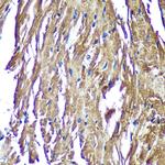 NDUFAF4 Antibody in Immunohistochemistry (Paraffin) (IHC (P))