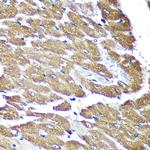 NDUFAF4 Antibody in Immunohistochemistry (Paraffin) (IHC (P))