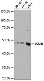 SCRN3 Antibody in Western Blot (WB)