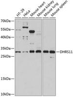 DHRS11 Antibody in Western Blot (WB)