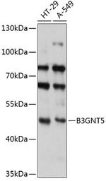 B3GNT5 Antibody in Western Blot (WB)