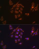 TRH Antibody in Immunocytochemistry (ICC/IF)