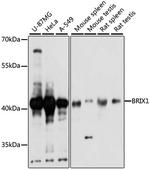 BXDC2 Antibody in Western Blot (WB)