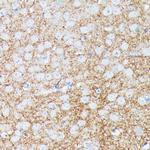 gamma Synuclein Antibody in Immunohistochemistry (Paraffin) (IHC (P))