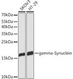 gamma Synuclein Antibody in Western Blot (WB)
