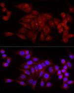 SNRPD1 Antibody in Immunocytochemistry (ICC/IF)