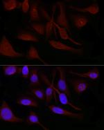 SNRPD1 Antibody in Immunocytochemistry (ICC/IF)