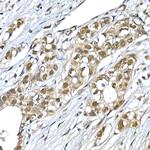 SNRPD1 Antibody in Immunohistochemistry (Paraffin) (IHC (P))