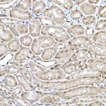 SNRPD1 Antibody in Immunohistochemistry (Paraffin) (IHC (P))