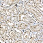 SNRPD1 Antibody in Immunohistochemistry (Paraffin) (IHC (P))