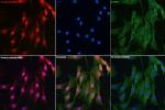 DYNLL1 Antibody in Immunocytochemistry (ICC/IF)