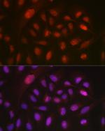 DYNLL1 Antibody in Immunocytochemistry (ICC/IF)