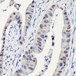 DYNLL1 Antibody in Immunohistochemistry (Paraffin) (IHC (P))