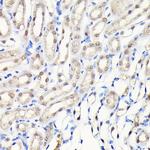 DYNLL1 Antibody in Immunohistochemistry (Paraffin) (IHC (P))