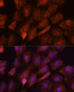 SMYD3 Antibody in Immunocytochemistry (ICC/IF)