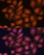 SMYD3 Antibody in Immunocytochemistry (ICC/IF)