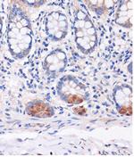 SMYD3 Antibody in Immunohistochemistry (Paraffin) (IHC (P))