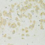 SLC37A4 Antibody in Immunohistochemistry (Paraffin) (IHC (P))