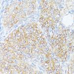 SLC7A2 Antibody in Immunohistochemistry (Paraffin) (IHC (P))