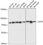 LZTS2 Antibody in Western Blot (WB)