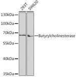 Butyrylcholinesterase Antibody in Western Blot (WB)