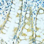 CYP2B6 Antibody in Immunohistochemistry (Paraffin) (IHC (P))