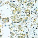 CYP2B6 Antibody in Immunohistochemistry (Paraffin) (IHC (P))