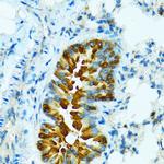 CYP2B6 Antibody in Immunohistochemistry (Paraffin) (IHC (P))