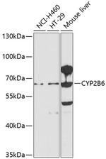 CYP2B6 Antibody in Western Blot (WB)