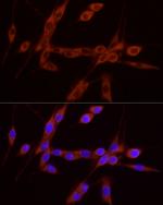 GDNF Antibody in Immunocytochemistry (ICC/IF)