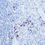 TLR9 Antibody in Immunohistochemistry (Paraffin) (IHC (P))