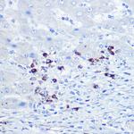 TLR9 Antibody in Immunohistochemistry (Paraffin) (IHC (P))