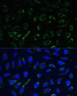 IDH3A Antibody in Immunocytochemistry (ICC/IF)