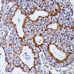 IDH3A Antibody in Immunohistochemistry (Paraffin) (IHC (P))
