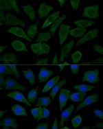 COX15 Antibody in Immunocytochemistry (ICC/IF)