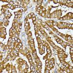 COX15 Antibody in Immunohistochemistry (Paraffin) (IHC (P))