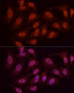 WTAP Antibody in Immunocytochemistry (ICC/IF)