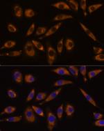 GNAQ Antibody in Immunocytochemistry (ICC/IF)