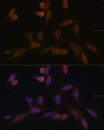 NDUFA5 Antibody in Immunocytochemistry (ICC/IF)