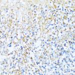 NDUFA5 Antibody in Immunohistochemistry (Paraffin) (IHC (P))