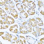 NDUFA5 Antibody in Immunohistochemistry (Paraffin) (IHC (P))